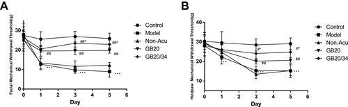 Figure 3 Electroacupuncture (EA) treatment alleviated impairments in the mechanical withdrawal thresholds of the face (A) and hind-paw (B) in rats subjected to dural electrical stimulation. Data are presented as the mean ± standard deviation, n=10/group; Model group vs Control group (**P<0.01, *** P<0.001), GB20, GB20/34 group vs Model group (#P<0.05, ## P<0.01), GB20 group vs GB20/34 group(^P<0.05).