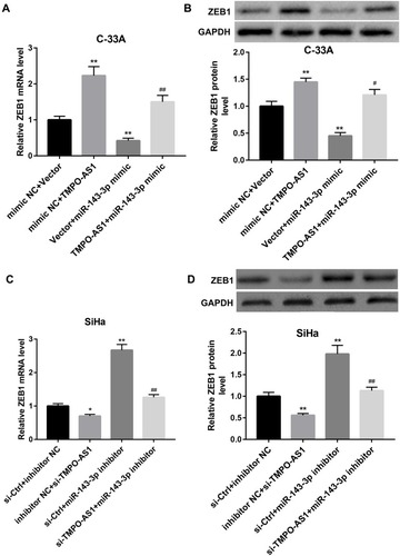 Figure 4 Effect of TMPO-AS1 overexpression and knockdown on the miR-143-3p regulation of ZEB1 expression. qRT-PCR analysis of ZEB1 mRNA level (A) and Western blot analysis of ZEB1 protein level (B) in C-33A cells co-transfected with pcDNA3.1-TMPO-AS1/empty vector and miR-143-3p mimic/mimic NC. **P<0.01, vs mimic NC+vector; #P<0.05, ##P<0.01, vs mimic NC+ TMPO-AS1 or vector+ miR-143-3p mimic. qRT-PCR analysis of ZEB1 mRNA level (C) and Western blot analysis of ZEB1 protein level (D) in SiHa cells co-transfected with si-TMPO-AS1/si-Ctrl and miR-143-3p inhibitor/inhibitor NC. *P<0.05, **P<0.01, vs inhibitor NC+si-Ctrl; ##P<0.01, vs inhibitor NC+ si-TMPO-AS1 or si-Ctrl+ miR-143-3p inhibitor. N=3.