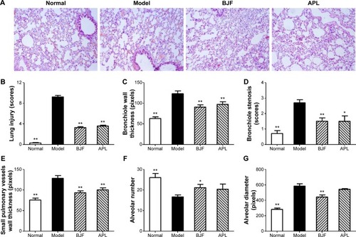 Figure 5 Effects of Bufei Jianpi formula (BJF) and aminophylline (APL) on histological changes in hematoxylin and eosin (H&E)-stained lung sections of chronic obstructive pulmonary disease (COPD) rats.