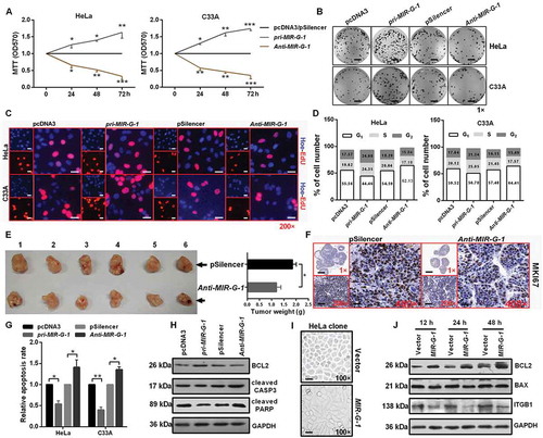 Figure 3. MIR-G-1 promotes cell proliferation and tumor growth, and inhibits apoptosis and anoikis. (a) MTT assay showed that overexpression of MIR-G-1 promoted cell viability. (b) Colony formation ability was higher after transfection with pri-MIR-G-1. Scale bar: 50 mm. (c) EdU assay was used to detect cell proliferation. Scale bar: 80 μm. (d) Flow cytometric cell cycle analysis showed that MIR-G-1 overexpression results in a significant decrease in the cellular population in the G0/G1 phase. (e) Representative graph of tumor size and the mean tumor weights 30 days after inoculation. (f) MKI67 expression in tissues was shown by IHC. Scale bar: 80 μm. (g) Flow cytometric apoptosis showed that MIR-G-1 overexpression significantly decreased the apoptosis rate in HeLa and C33A cells. (h) BCL2, cleavage of CASP3 and PARP expression level in the indicated plasmid-transduced HeLa cells after TAX (3 µg/ml) for 24 h was shown by western blot assay. (i) External cell morphology was analyzed using microscopy. Scale bar: 80 μm. (j) Western blot results for ITGB1, BCL2 and BAX in the indicated HeLa cells. Experiments were performed 3 times, and data are presented as means ±SD. *P < 0.05; **P < 0.01; ***P < 0.001; ns, not significant.