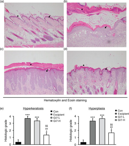 Fig. 3 Histological changes of skin in NC/Nga mice. H&E-stained dorsal skin lesions were observed in the control (a), excipient (b), GI7-L (c), and GI7-H (d) groups. GI7-H is demonstrated to have an inhibitory effect on hyperkeratosis (arrowhead) (e) and hyperplasia (arrow) (f) of AD-like skin lesions compared with the excipient and GI7-L group. Results are expressed as the mean+SD (n=6). *p<0.05, ***p<0.001 versus the control group; # p<0.05, ## p<0.01 versus the excipient group; §§ p<0.01 versus the GI7-L group.