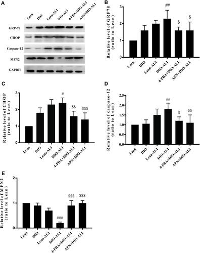 Figure 2 APN and 4-PBA alleviate the ER stress during ALI. (A) Western blot analysis for ER stress marker proteins and the mitochondria-ER physical coupling protein in lung tissues before and after LPS administration. Densitometry analysis of the expression of GRP78 (B), CHOP (C), Caspase 12 (D) and MFN2 (E). Data are presented as the mean ± SD. #, ##, ###p < 0.05, 0.01, 0.001 vs DIO; $, $$, $$$p < 0.05, 0.01, 0.001 vs DIO-ALI.