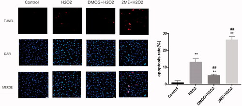 Figure 8. HIF-1α reduced ROS-induced cell damage. TUNEL staining was used to detect apoptosis of cells treated with H2O2 for 1 h. The data shown are the means of three independent experiments. The error bars represent standard error. Data were analyzed with one-way analysis of variance (∗∗p < .01, vs. control; ##p < .01, vs. H2O2).