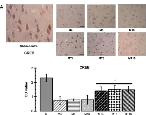 Figure 2 The expression of CREB and pCREB in the hippocampus by immunohistochemistry and Western blotting.