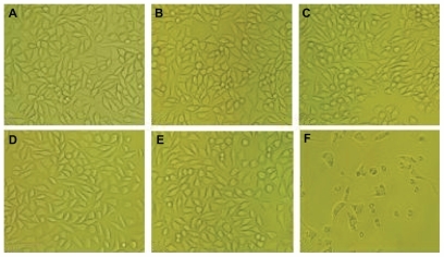 Figure 2 Morphology analysis of L929 cells incubated at different concentrations of Fe3O4@Au composite magnetic nanoparticles leaching liquor. (A) Negative control; (B) 25% leaching liquor; (C) 50% leaching liquor; (D) 75% leaching liquor; (E) 100% leaching liquor; and (F) positive control.Note: Inverted microscopy, ×100 magnification.