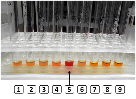 Figure 6. The HEMPAS test shows lysis of the patient's red cells in four of five control sera (tube 5 shows lysis in one control, arrow) but not her own serum (tube 8).