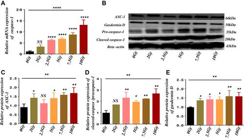 Figure 3 Gamma radiation enhances the inflammasome activation of Caspase-1 dependent and independent pyroptosis in microvascular endothelial cells.