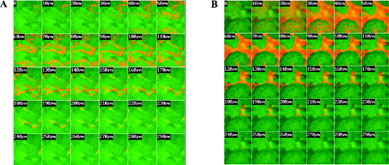 FIG. 4. CLS micrograph skin optical sections showing fluorescein sodium penetration from aqueous solution into human skin. Receiver compartment containing (A) 50% hydroethanolic solution or (B) water.