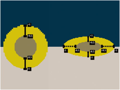 Figure 2. Schematic overview of the acquisition of data from the three-dimensional tumor models. The taupe colored necrotic tumor core is encapsulated by the yellow viable tumor tissue which is embedded in the healthy intestinal tissue while fluid flows over the tumors along the horizontal axis. Spherical models are probed along the vertical axes, seen on the left side while the spheroid models are probed along the vertical and horizontal axes, in this paper also referred to as minor and major axis, respectively. The coordinates represent normalized coordinates, normalized by the total length of the probe-line. These coordinates are also used in Figure 5 for an adequate comparison of the pressure and drug profiles for different tumor sizes.