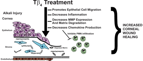 Figure 1 Tβ4 promotes corneal wound healing. By modulating the corneal inflammatory response and promoting re-epithelialization in response to injury, Tβ4 may be a new a therapeutic option for ophthalmologists treating corneal inflammatory and wound healing disorders.