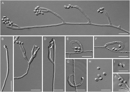 Figure 14. Neobulgaria koningiana (ex-type MUCL 9775). A–G. Phialides with conidia (MLA slide cultures, 10 d). H–J. Conidia (MLA, 10 d). Bars = 10 μm.