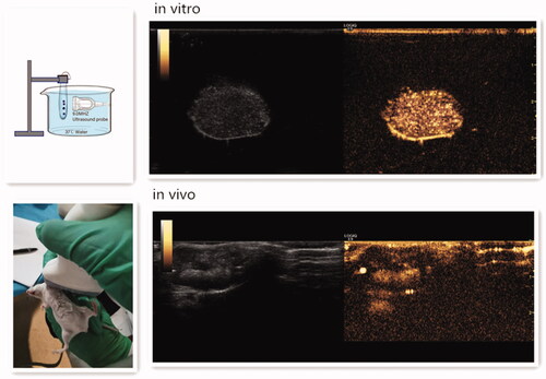 Figure 4. Ultrasound enhancement images of DOX-BCNDs in vitro and in vivo.