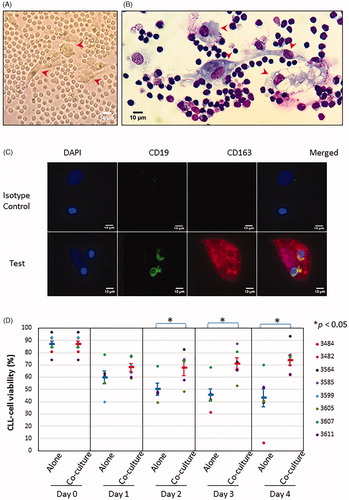 Figure 1. Characterization of nurse-like cells (NLCs). Fresh CLL mononuclear cells were cultured at a cell density of 10 × 106/mL for up to 14 days as described in Methods. (A) Phase contrast image of one CLL sample cultured on day 6, showing CLL cells appearing as small circular/oval-shaped cells with <10µm in diameter and NLCs displaying a larger more pleomorphic morphology such as large oval-shaped as well as elongated (red arrow head). (B) May Grünwald Giemsa stained NLCs seen under oil immersion showing multiple clusters of pleomorphic macrophages closely surrounded by CLL cells of a dark stained nucleus with a high N:C ratio. The NLCs have a broad range of morphology from large oval appearance to elongated and spindle-shaped and having characteristic vacuoles with granular cytoplasm (red arrow head). (C) Immunofluorescence microscopy staining of NLCs developed after 9 days of culture for CD163 (red) and counterstained with DAPI (blue). CLL cells were stained with CD19 (green) and counterstained with DAPI (blue). The respective isotype antibodies were used as controls. (D) NLCs in co-culture with thawed autologous CLL cells protected CLL cells against spontaneous cell death. Viability of CLL cells was measured by Annexin V/PI staining by flow cytometry. Each data point represents mean ± SEM of 8 independent experiments using 8 different CLL samples. *Refers to p value of <0.05.
