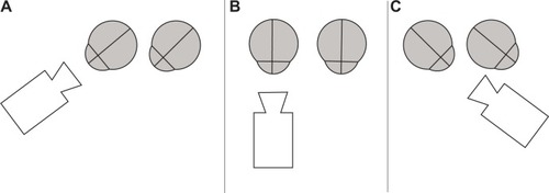 Figure 1 Schematic drawing of camera positions while video capturing side glance to the right (A), primary position (B), and side glance to the left (C) for analysis of the right eye.