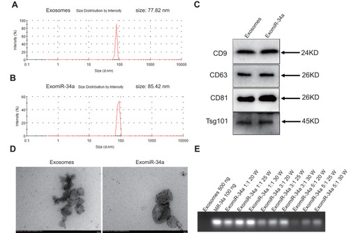 Figure 1 Synthesis and characterization of exomiR-34a. Exosomes were isolated from supernatant of HEK293 cells as described in Material and Methods section. An ultrasound method was used to synthesize the exomiR-34a. The properties of exosomes and exomiR-34a were analyzed by Zetasizer (A and B). The expression of specific markers of exosomes and exomiR-34a was determined by Western blot (C). The morphology of exosomes and exomiR-34a were observed under transmission electron microscopy (D). The loading rate of miR-34a in exomiR-34a was determined using agarose gel electrophoresis (E).