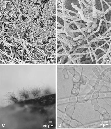 Figure 1. Micrographs of fungi associated with southern right whale neonate skin. (A, B) Scanning electron micrographs showing fungal growth on the whale skin. (B) Scanning electron micrograph of an early formation of a fruiting body. (C) Fruiting bodies (ascomata) of C. globosum on a section of whale skin. (D) Light micrograph of unusually formed cells of C. globosum starting to form the textura intrica/epidermoidea of the peridium (fruit body wall).