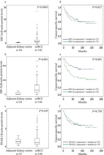 Figure 1. Box plot represents the expression of (a) HIF-1α, (b) HIF-2α, and (c) SNAIL1 protein in the kidney cortex compared with ccRCC tumors (Mann-Whitney U-test, significant at P< 0.05). Kaplan-Meier plots represents the cancer-specific survival curves of (d) HIF-1α, (E) HIF-2α, and (F) SNAIL1 protein levels in ccRCC (Kaplan-Meier survival analysis, significant at P < 0.05).