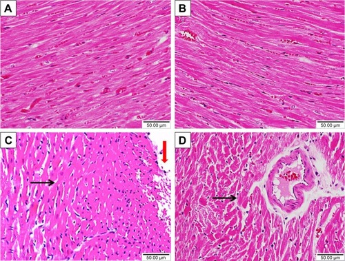 Figure 5 Effect of sitagliptin on histological changes in the heart of control and diabetic rats.