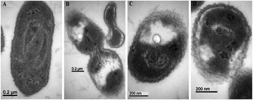 Figure 12. TEM images of strain GZ 0003 of Xanthomonas oryzae pv. oryzae (A) treated with double distilled water, and treatment with 8 µg/ml of zinc oxide nanoparticles synthesized by (B) Olive leaves (Olea europaea) (C) Chamomile flower (Matricaria chamomilla L.), (D) Red tomato fruit (Lycopersicon esculentum M). Magnification 100,000× for A and B; 150,000× for C and D; Bar = 0.2 µm for A and B; 200 nm for C and D.