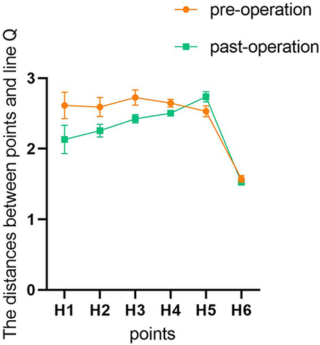 Figure 4 Graphical plots of the changes in the landmark data before and after surgery. The change in the position of the brows shown in.Figure 3 can be clearly seen in Figure 4.