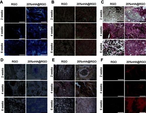 Figure 7 Histological analysis for in vivo bone defect repair by different staining methods: (A) DAPI, (B) Goldner, (C) Masson’s trichrome staining, (D) Toluidine blue, (E) ALP, and (F) OCN. The size bar is 200 μm (all the images). (A color image can be viewed online).Notes: Reprinted from Nie W, Peng C, Zhou X, et al. Three-dimensional porous scaffold by self-assembly of reduced graphene oxide and nano-hydroxyapatite composites for bone tissue engineering. Carbon. 2017;116:325–337. Copyright 2017, with permission from Elsevier.Citation197