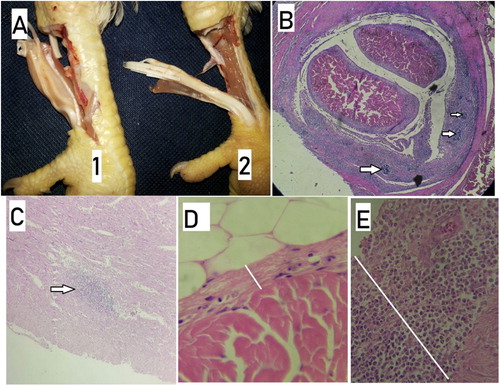 Figure 2. Pathological lesions of avian reovirus infections in broiler. A: Broiler with marked tenosynovitis in digital flexor tendon (1), compared with normal tendon (2); B: Histopathological lesion of tenosynovitis with lymphoid follicle formation (arrow); C: Myocarditis; D: normal synovium; E: marked synovitis.