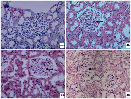 Figure 4. Histopathological study of renal tissue slice from test rats (40×) (A) normal rat; (B) DN rat; (C) DN rats treated with a lower dose of ACP; (D) DN rats treated with a higher dose of ACP).