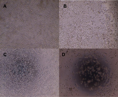 Figure 9 4T1 cell lines treated with different formulations: control cells (A); ferulic acid, 250 µM (B); nanosponges, 250 µM (C); ferulic acid-loaded nanosponges, 250 µM (D). Microscopic magnification ×10 K, after 24 hrs of incubation.