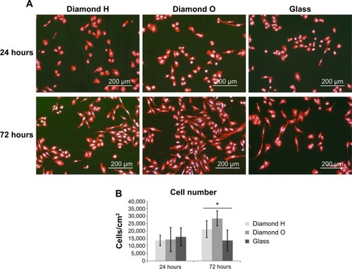 Figure 3 Cell adhesion and growth on NCD films.Notes: Fluorescence microscopy images showing the morphology of Saos-2 cells at 24 hours and 72 hours after seeding on H-terminated NCD films, on O-terminated NCD films, and on glass; Texas Red and Hoechst staining, fluorescence microscopy (Olympus IX 51) (A). Graph showing the number of Saos-2 cells at 24 hours and 72 hours after seeding on H-terminated NCD films, on O-terminated NCD films, and on glass; seeding density was 10×103 cells/cm2. The data from ten images in each group are expressed as the mean ± SD. *Statistically significant at P≤0.05 (B).Abbreviations: NCD, nanocrystalline diamond; SD, standard deviation.