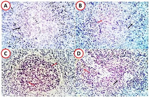 Figure 3. Positively immunostained CD20 cells (red arrows) and negative cells (black arrows) in the spleens of various supplemented groups. (A: LVEO0, B; LVEO200, C; LVEO400, D; LVEO600. Bar 20. Magnification: × 400.