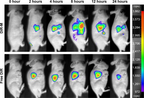 Figure 4 Fluorescence images of the mice bearing A549 cells on right side at different time points after intravenous injection of DiR-loaded mixed micelles.Abbreviations: DiR, 1,1-Dioctadecyl-3,3,3,3-tetramethylindotricarbocyanine; DiR-M, DiR-loaded mixed micelles composed of TPGS and Solutol HS 15.