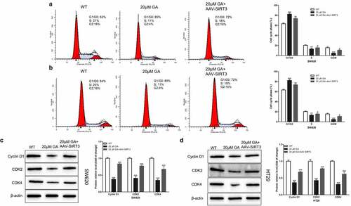 Figure 4. Glycyrrhizic acid blocks colorectal cancer cells in G1/G0 stage by inhibiting SIRT3 in vitro. (a,b) Flow cytometry analysis of cell cycle in SW620 (a) and HT29 (b) cells, Representative cell cycle diagrams are shown on the left, and statistical comparison cubes are shown on the right. (c,d) Western blot analysis of Cyclin D1, CDK2 and CDK4 protein expression in SW620 (c) and HT29 (d) cells after stimulating with 0 or 20 μmol/L glycyrrhizic acid for 24 hours. Each test is repeated at least 3 times independently. ** P < 0.01 and *** P < 0.001 vs WT group. # P < 0.05, ## P < 0.01 and ### P < 0.001 vs 20 μM GA group.