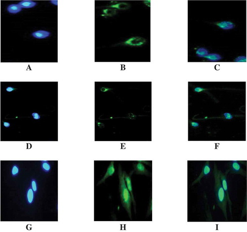 Figure 4. PPARγ protein localization by Immunocytofluorescent Assay. (A-C): Representative immunolocalization of PPARγ in ejaculated spermatozoa of a normozoospermic man. (A) DAPI for nuclear staining. (B) PPARγ detection. (C) Merged images of (A) & (B). PPARγ localized mainly to the sperm midpiece and post-acrosomal regions. A reactivity was also observed in the cytoplasmic droplet. (D-F): Representative immunolocalization of PPARγ in ejaculated human spermatozoa from an asthenozoospermic man. (D) DAPI for nuclear staining. (E) PPARγ detection. (F) Merged images of (D) & (E). PPARγ localized mainly to the sperm midpiece and post-acrosomal regions. A reactivity was also observed in the cytoplasmic droplet. (G-I): Representative immunolocalization of PPARγ in human adipose cells. (G) DAPI for nuclear staining. (H) PPARγ detection. (I) Merged images of (G) & (H). In human adipose cells used as qualitative and semi-quantitative references for PPARγ detection, a strong reactivity towards the antibody was recorded in the nuclear compartment and to a lesser extent in the cytosolic compartments.
