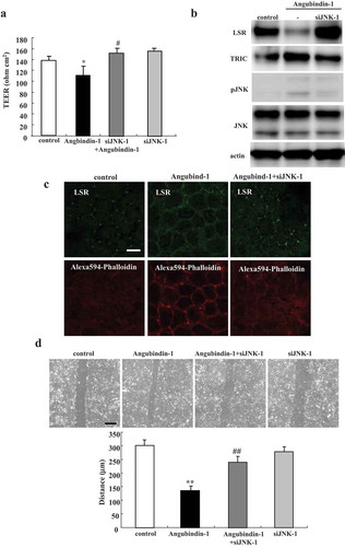 Figure 6. Knockdown of JNK prevents effects of angubindin-1 in Sawano cells.(a) Bar graph of TEER values representing barrier function of Sawano cells pretreated with transfection of siRNA of JNK before with or without 2.5 μg/ml angubindin-1. *p < .05, vs control. #p < .05, vs angubindin-1. (b) Western blot analysis for LSR, TRIC, pJNK and JNK in Sawano cells pretreated with transfection of siRNA of JNK with or without 2.5 μg/ml angubindin-1. (c) Immunocytochemical analysis for LSR (green) and F-actin (Alexa 594-Phalloidin, red) in Sawano cells pretreated with transfection of siRNA of JNK with or without 2.5 μg/ml angubindin-1. Bar: 5 μm. (d) Migration assay of Sawano cells pretreated with transfection of siRNA of JNK with or without 2.5 μg/ml angubindin-1. Bar: 100 μm. **p < .01, vs control. ##p < .01, vs angubindin-1.