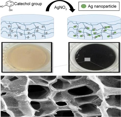 Figure 8 A new strategy that uses catecholic chemistry to synthesize antimicrobial silver nanoparticles impregnated into antifouling zwitterionic hydrogels.Notes: On the top is the schematic illustration of the combination of AgNPs and antifouling hydrogel. In the middle, Photographs show the changes in color of hydrogels by changing the pH because of reaction that converts the Ag+ into solid AgNPs. The bottom section shows the surface structure and the morphology of hydrogel via scanning electron microscopy. Reprinted with permission from GhavamiNejad A, Park CH, Kim CS. In situ synthesis of antimicrobial silver nanoparticles within antifouling zwitterionic hydrogels by catecholic redox chemistry for wound healing application. Biomacromolecules. 2016;17(3):1213–1223. Copyright (2016), American Chemical Society.Citation287