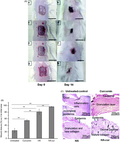 Figure 5. Effect of HA, curcumin and HA–cur conjugate on healing of wounds of diabetic mice. (A) Representative images of wounds on day 0 and 14; (a, b) untreated, treated with (c, d) curcumin, (e, f) HA, (g, h) HA–cur conjugate. Scale bar: 1 cm. (B) Wound closure (%) on day 14 of different treatment groups. Wound closure (%) was calculated with respect to initial wound area on day 0. In each group, six mice were used, **p < .05 (ANOVA) between different groups. (C) Histological evaluation of untreated and wounds treated with curcumin, HA and HA–cur conjugate. HA (210 µg/ml), curcumin (25 µM) or HA–cur containing equivalent concentration of curcumin was applied topically on excisional wounds of diabetic mice for 3 days at an interval of 24 h. Scale bar: 200 µm.