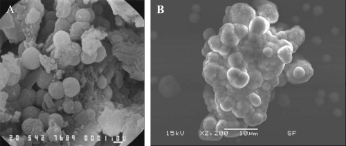 Figure 2 SEM images showing the similarity of apatite spheres in various sizes in the core of an oxalate kidney stone (A) and apatite formations in the CNP culture (B). Bars = A; 1 μm, B; 10 μm.
