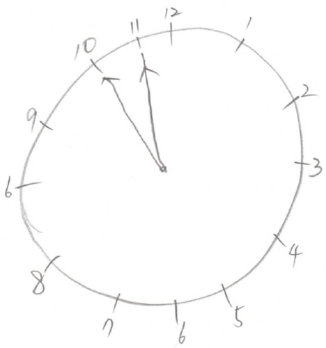 Figure 3 Clock drawing test.