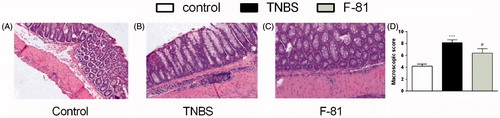 Figure 4. Representative images of haematoxylin- and eosin-stained sections of distal colon obtained from the prevention mouse model of colitis for control (Panel A), TNBS-treated group (Panel B), TNBS- and F-81-treated group (Panel C). Microscopic damage score (Panel D). Statistical significance was assessed using one-way ANOVA and post hoc multiple comparison Student–Newman–Keuls test. ***p < .001, as compared with controls. #p < .05, ###p < .001, vs. TNBS-treated animals. Data represent mean ± SEM of eight mice per group.