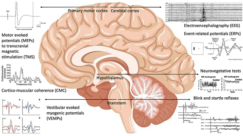 Figure 1 Neurophysiological findings in RBD population: Overview of the main electrophysiological techniques that have provided insights on the neurophysiological basis of RBD. Cortical activity is explored with conventional electroencephalography (EEG) and event-related potentials (ERPs). Cortico-muscular coherence (CMC) relates to the synchrony in the neural activity of brain’s cortical areas and muscles, thus allowing to study the neural control of movement. Motor evoked potentials (MEPs) to transcranial magnetic stimulation (TMS) specifically probe the excitation state of the primary motor cortex. Neurovegetative tests can be applied to functionally assess the hypothalamus, a key region for the central control of the autonomic nervous system. Finally, vestibular evoked myogenic potentials (VEMPs), as well as blink and startle reflexes, are suitable tools to evaluate the brainstem excitability.