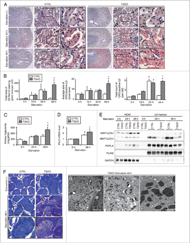 Figure 6. Autophagy-deficiency impairs LD degradation under prolonged starvation in the proximal tubules in vivo. Kidneys of atg5-TSKO and atg5F/F-CTRL mice, that were fed or starved for up to 48 h, were analyzed for the LD degradation (A to C, n = 10 to 14; D, n = 7 to 9; E, n = 5 to 6; F to I, n = 3 in each group). (A) Images of Oil Red O-stained kidney sections. Counterstaining was performed with hematoxylin. (B) Quantification of the Oil Red O staining. (C to E) TGs level per kidney weight (gKW) (C) and mRNA expression level of Plin2 in the kidney (D), immunoblots of the indicated molecules using homogenates (HOM) and isolated LD fraction from the whole kidney (E), and images of toluidine blue-stained kidney sections (F) are shown. (G to I) Transmission electron microscopy images of 48-h starved atg5-TSKO mice. BM, basement membrane. (D) Data are expressed as the fold change relative to the mean value of fed atg5F/F-CTRL mice. Bars: 50 μm (A), 10 μm (F and G), 5 μm (H), and 2 μm (I). All images are representative of multiple experiments. Data are provided as mean ± SE. Statistically significant differences (*P < 0.05 vs. 48-h starved atg5F/F-CTRL mice; #P < 0.05 vs. fed mice) are indicated. CTRL, atg5F/F-CTRL mice; TSKO, atg5-TSKO mice.