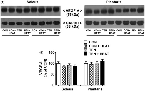 Figure 4. Effects of tenotomy and heat stress on VEGF-A protein expression of soleus and plantaris muscles. (A) Representative VEGF-A protein expression evaluated by Western blotting. (B) Quantified data of VEGF-A. VEGF-A band density was normalised to GAPDH (n = 6 rats/group; one-way ANOVA with Newman–Keuls post hoc test).