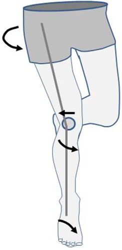 Figure 4 Drawing showing the dynamic valgus.