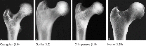 Figure 36. Radiographs of Hominid hips with head-neck ratios (head largest diameter divided by smallest neck width). The human hip has the thickest neck, decreasing offset and impingement-free motion. Also note thicker cortical bone in the superior femoral neck of the apes (from Lovejoy Citation2005, with permission). AP view, not to scale.