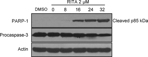 Figure 4. PARP-1 and procaspase-3 cleavage was induced in NALM-6 cells by RITA. Cells were treated as described in the legend to Fig. 2, harvested at the indicated times, and examined by immunoblotting with the indicated antibodies. Equal loading was verified using anti-actin antibody. One representative experiment of at least three performed is presented.