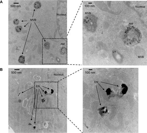 Figure 4 Uptake and trafficking of TAgNPs visualized by TEM. (A) Electron micrographs show degraded particles in multivesicular bodies and amphisomes in MDA-MB-231 cells after 3 hours at 11000X magnification (left) or 30000X magnification (right). (B) Electron micrographs show degraded particles in endosomes in MCF-10A cells after 3 hours at 11000X magnification (left) or 30000X magnification (right). EN, endosome; AM, amphisome; LY, lysosome; MVB, multivesicular body.