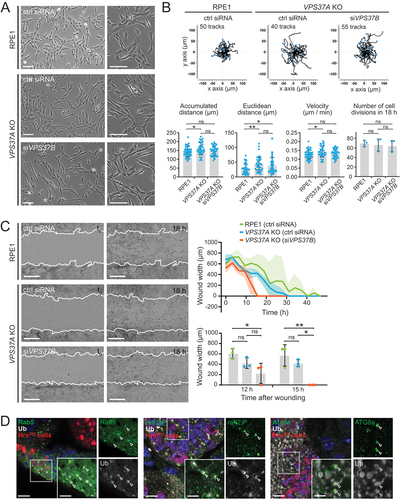 Figure 7. Simaphagy controls directed cell migration and can be detected in vivo. (a) Representative phase contrast images of RPE-1 control cells, VPS37A KO cells with and without knockdown of VPS37B using siRNA. Knockout of VPS37A leads to a more elongated cell morphology, a phenotype that is enhanced by knockdown of VPS37B. Scale bar: 100 µm. (b) Quantification of random migration patterns in RPE-1 control and VPS37A KO cells with and without VPS37B knockdown. 40-55 cells have been tracked for each condition over an imaging period of 18 h, with 20 min imaging intervals. Velocity, accumulative- and Euclidean distance are shown for each condition. The proliferation rate was manually scored for the imaging time of 18 h. One-way ANOVA *p < 0.05, **p <0.001, ns = not statistically significant. (c) Representative images and quantifications of wound healing assays performed with RPE-1 control and VPS37A KO cells with and without knockdown of VPS37B. VPS37A KO cells have an elevated migratory potential. This is further increased by a knockdown of VPS37B. Wound is shown at 1 h and 18 h after wounding (white line indicating cell front at t0 = 1 h). Scale bar: 300 µm. Average wound width over time and quantification of wound width at 12 h and 15 h are shown. Quantifications from 3 areas per condition. One-way ANOVA *p < 0.05, **p <0.001, ns = not statistically significant. (d) Representative immunofluorescence staining in Drosophila eye-antennal discs. Left: Clusters of Hrs28D cells (marked by nuclear RFP) display enlarged Rab5-positive endosomes with accumulating ubiquitin. The ref(2)P (middle panel) and Atg8a (right panel) proteins are recruited to ubiquitin-labelled enlarged endosomes in HRS28D larvae. Scale bar: 10 µm, insets 5 µm.
