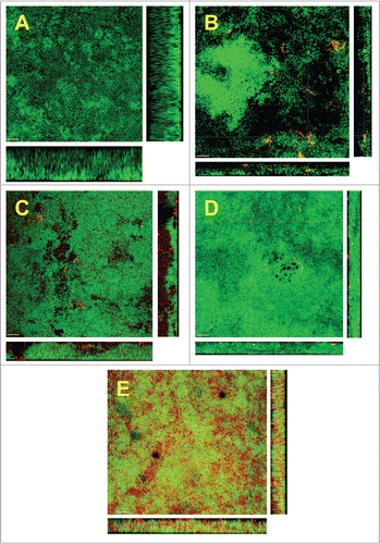 Figure 2. Confocal laser scanning microscopy (CLSM) images of the 6 species biofilm (control group; A), containing additionally Aggregatibacter actinomycetemcomitans (B), or Staphylococcus aureus (C), or Enterococcus faecalis (D), or Escherichia coli (E). Due to FISH staining of biofilms in B-F using Cy3-labeled probes (see Table 1), the newly added bacteria appear red. Non-hybridized bacteria appear green due to DNA staining (YoPro 1 + Sytox). The biofilm base in the cross sections is directed toward the top view. Scales = 10 μm.