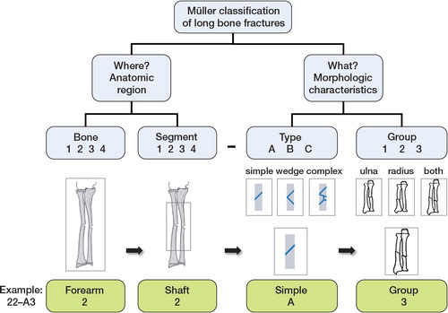 Figure 1. The Müller classification of long bone fractures.