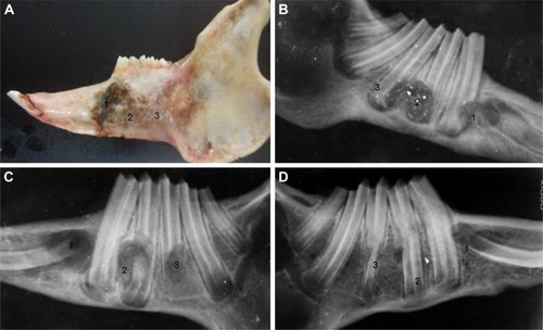 Figure 13 Analysis of bone defects.Notes: Morphology of rabbit bone defect at 8 weeks (A). X-ray image of rabbit bone defect at 2 weeks (B). X-ray image of rabbit bone defect at 4 weeks (C). X-ray image of rabbit bone defect at 8 weeks (D). 1: negative control; 2: PLGA/CS/nAg group; and 3: nPLGA/nCS/nAg.Abbreviations: CS, chitosan; nAg, silver nanoparticles; nCS, CS nanoparticles; nPLGA, PLGA nanoparticles; PLGA, poly(lactic-co-glycolic acid).